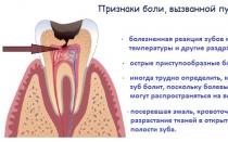 Болит зуб после еды Ужасная боль в зубах после еды питья