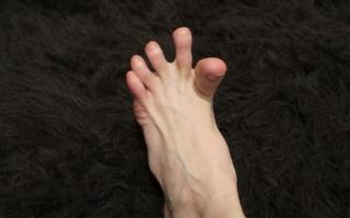 Судороги в ногах, как симптом заболеваний – какие патологии и состояния могут вызвать судороги ног?